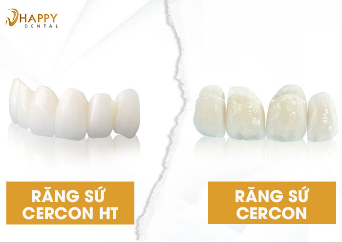 Răng sứ Cercon HT là gì ? Ưu điểm của răng sứ Cercon HT 