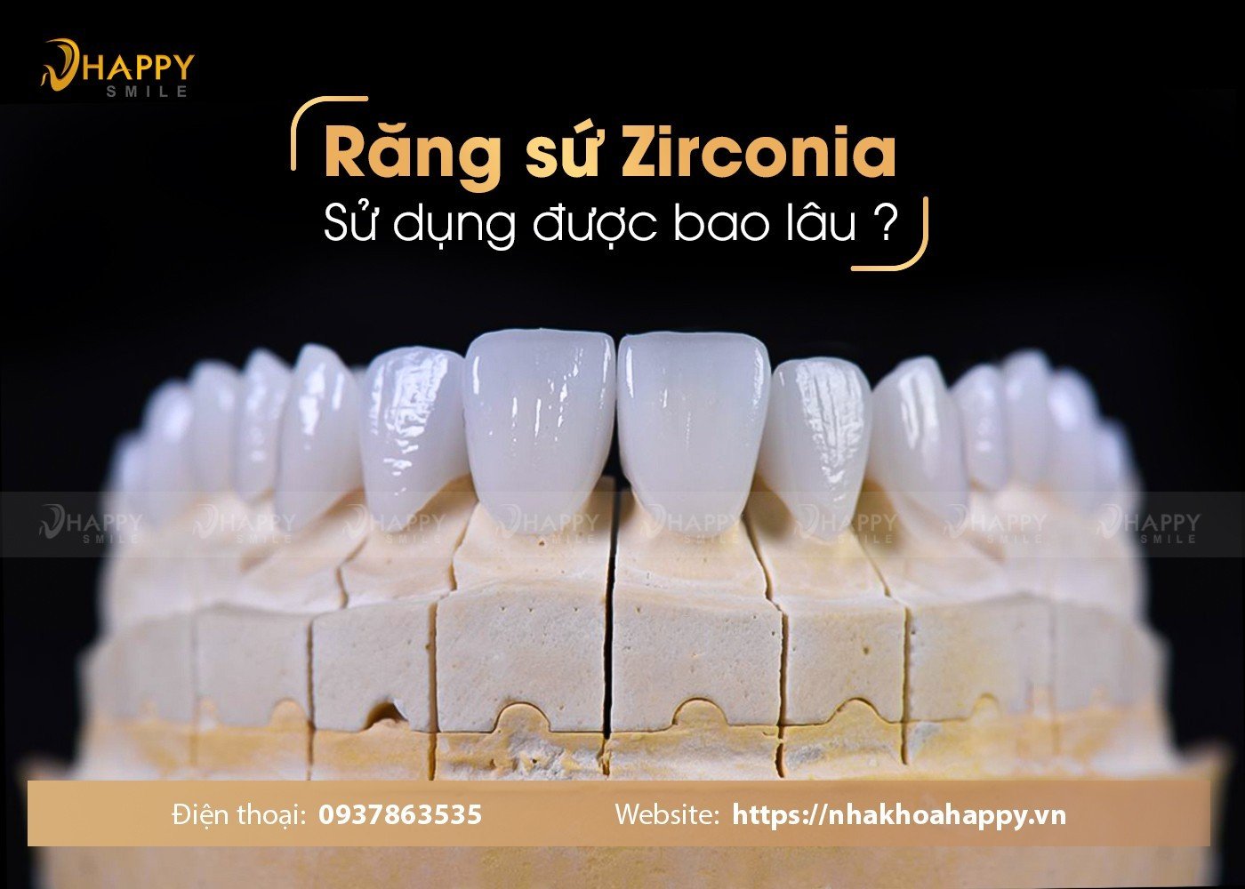 Tuổi thọ răng sứ zirconia là bao lâu? Cách chăm sóc răng sứ tốt nhất