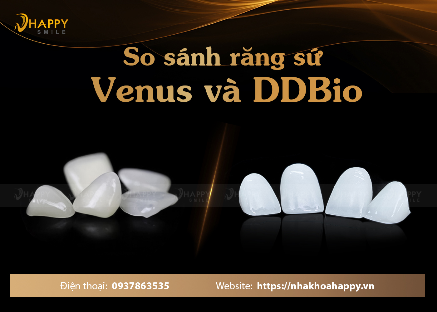 So sánh răng sứ Venus và DDBIO loại nào tốt hơn