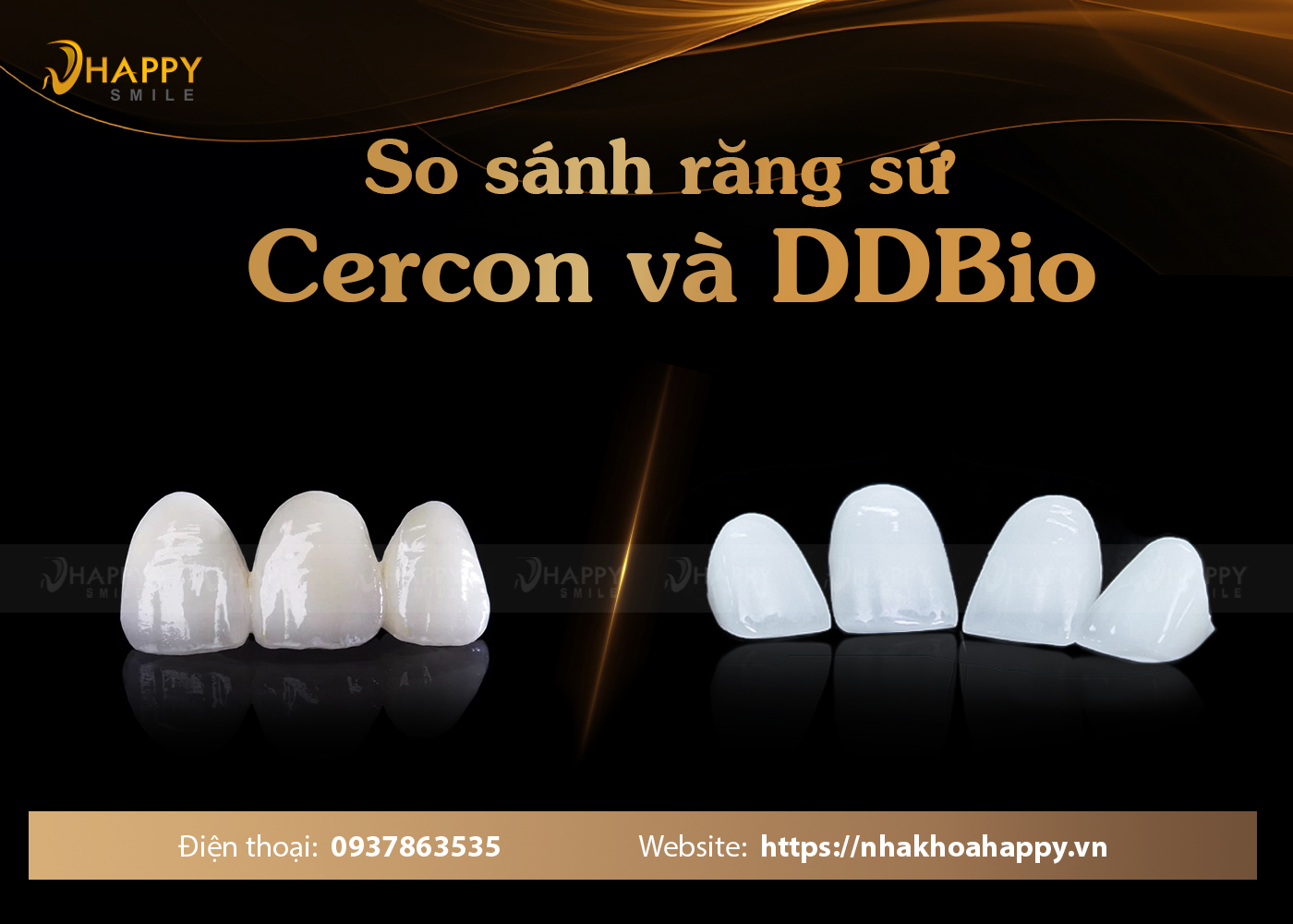 So sánh răng sứ Cercon và DDBIO loại nào tốt hơn
