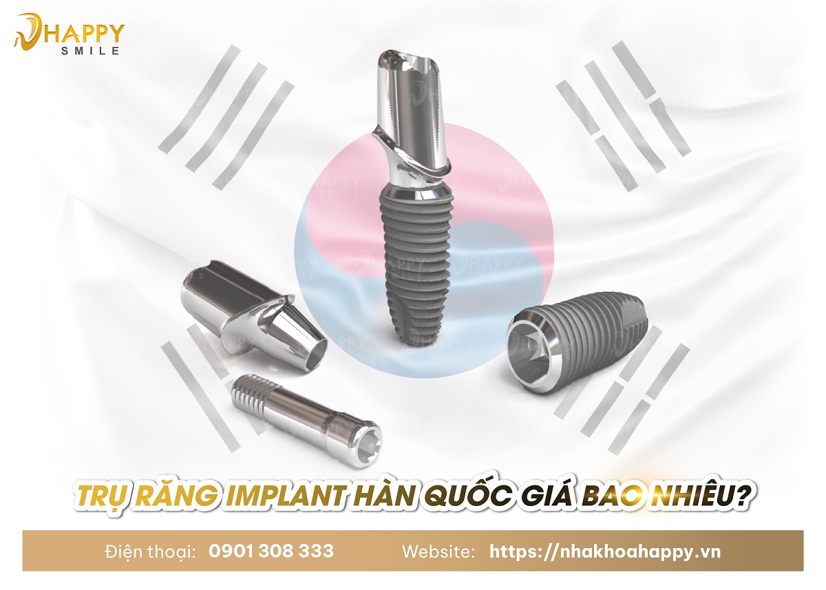 Trồng răng Implant Hàn Quốc giá bao nhiêu tiền