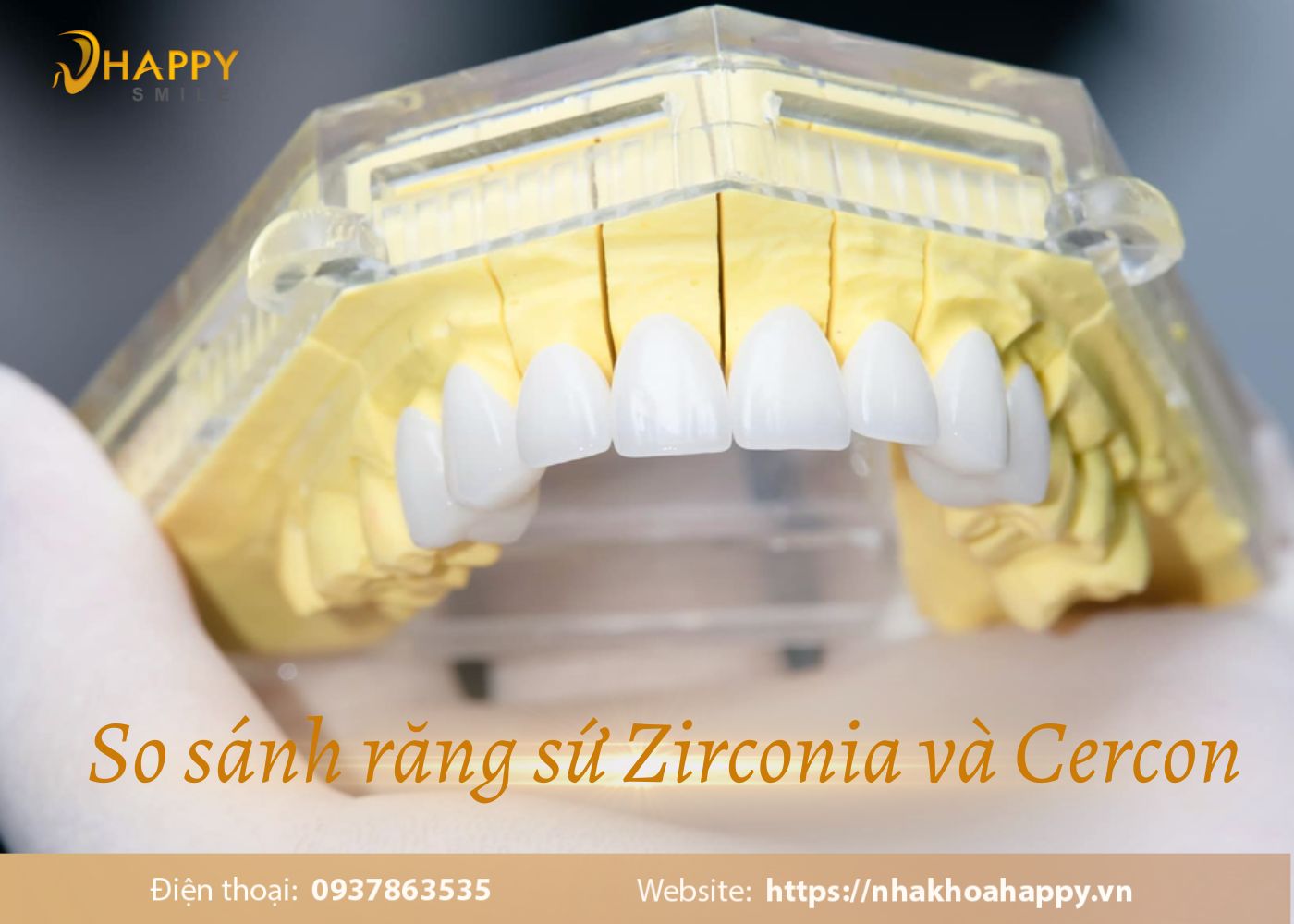 So sánh răng sứ Zirconia và Cercon nên dùng loại nào tốt nhất