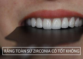 Răng toàn sứ Zirconia là gì? Ưu điểm dòng răng sứ Zirconia ?