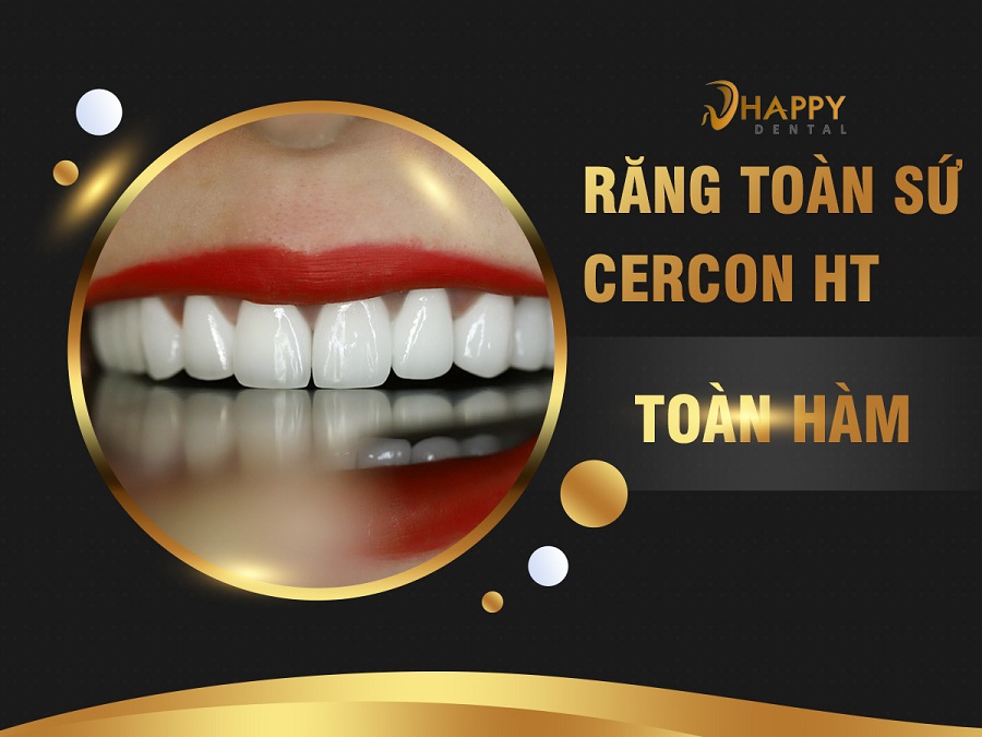 rang-su-cercon-ht-nhakhoahappy.jpg