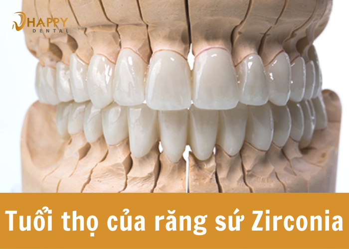 Tuổi thọ răng sứ zirconia là bao lâu? Cách chăm sóc răng sứ tốt nhất