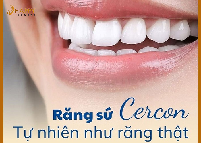 Răng sứ cercon của nước nào? Xuất xứ răng sứ cercon