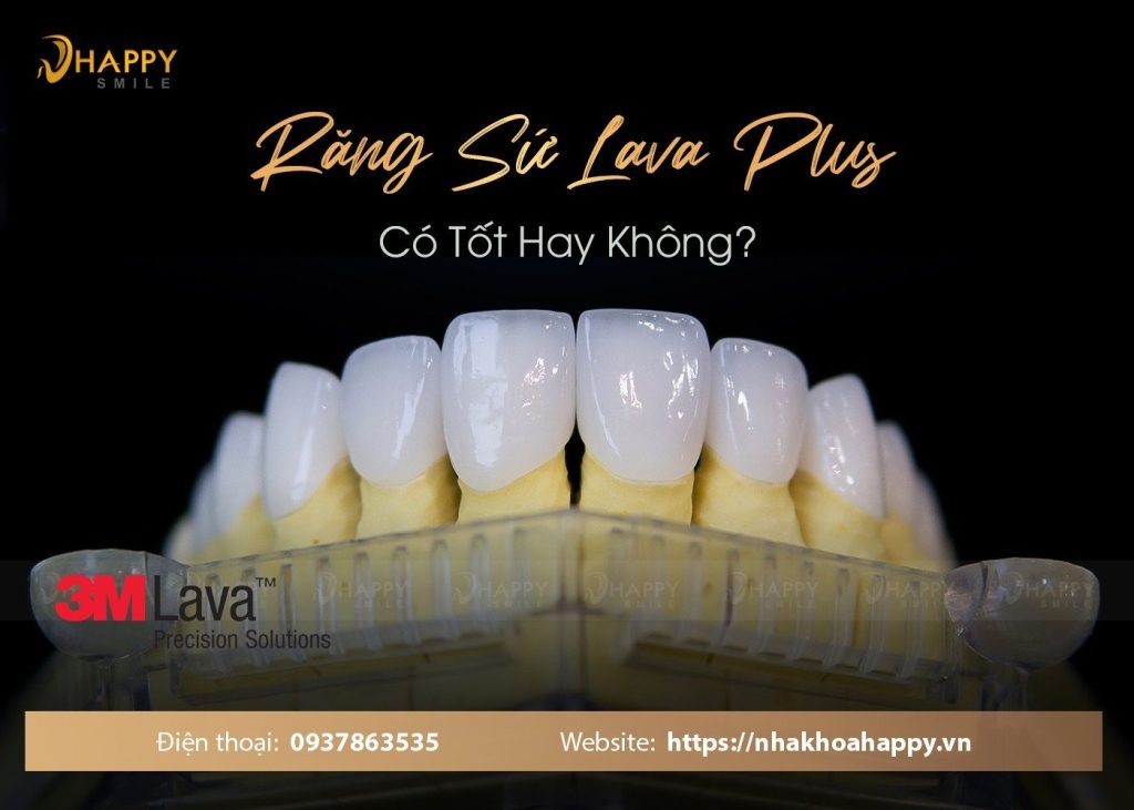 Răng Sứ Lava Plus Có Tốt Hay Không