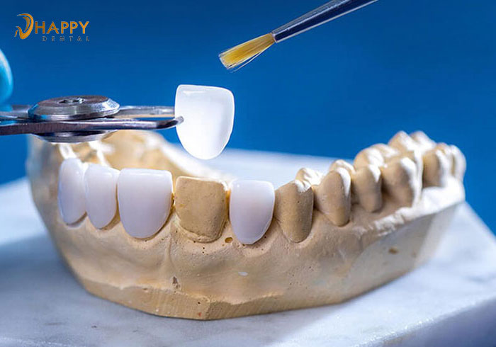 Răng sứ zirconia có mấy loại ? Răng sứ Zirconia loại nào là tốt nhất hiện nay