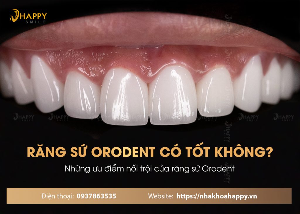 Răng sứ orodent có tốt không? Ưu điểm của răng sứ orodent